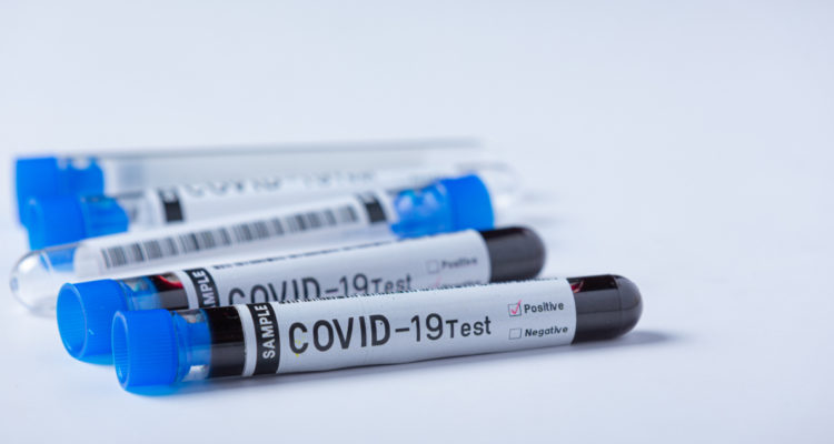 Reinfección por covid-19