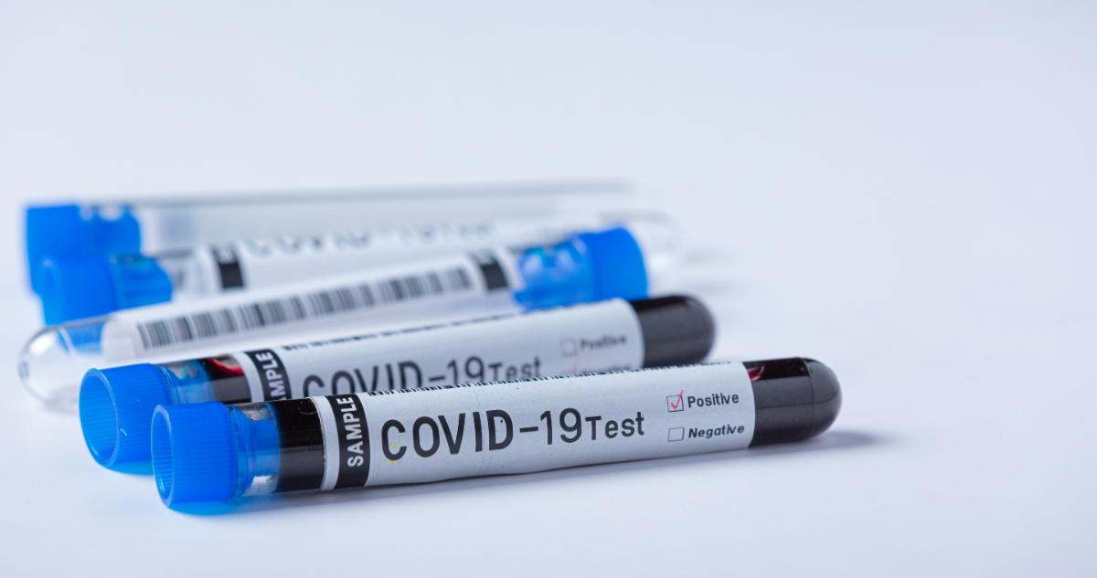 Reinfección por covid-19