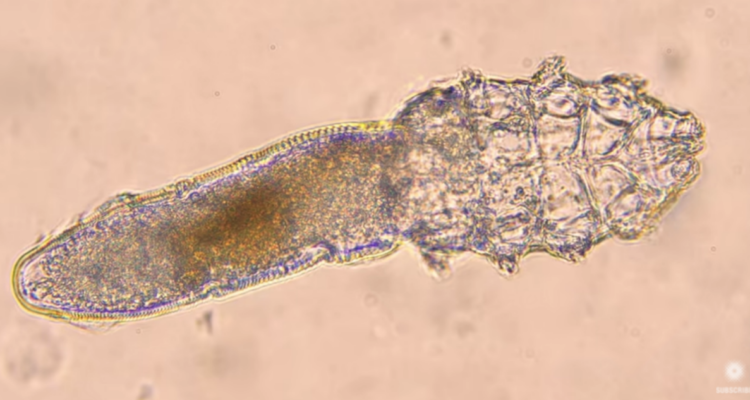Demodex