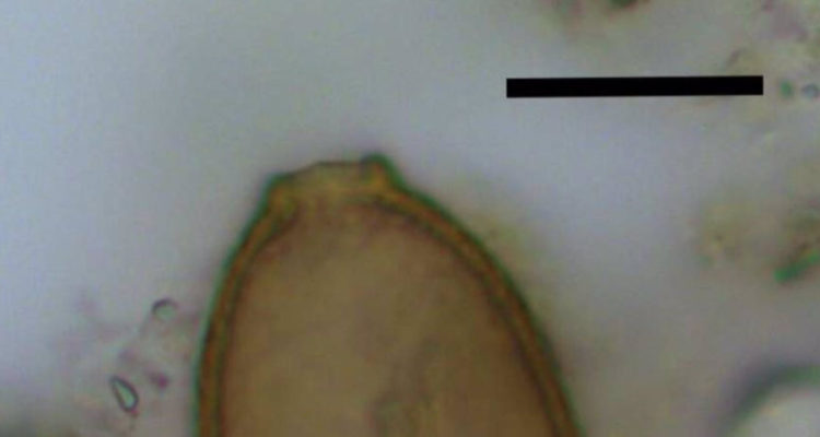 Huevo microscópico de gusano capillariido. La barra negra representa 20 micrómetros