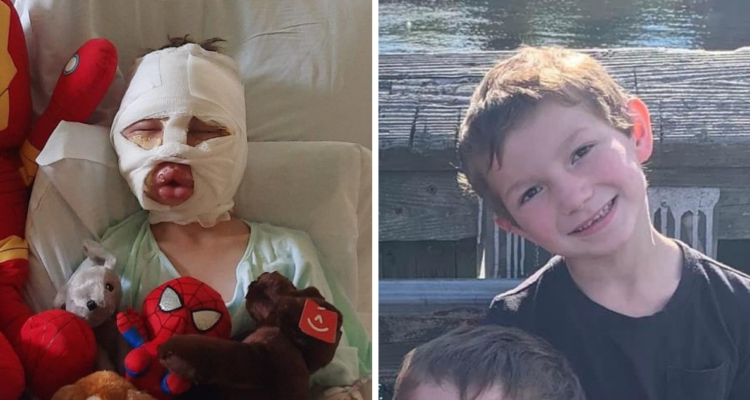 Dominick Krankall antes y después de la agresión