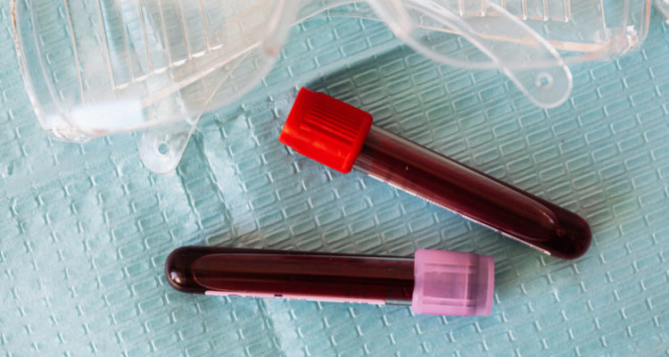 donacion-altruista-de-sangre