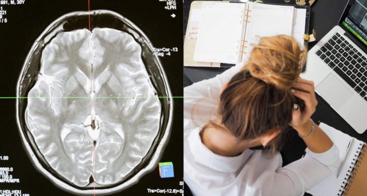 abrazo-de-la-mariposa-cerebero-ataque-de-ansiedad