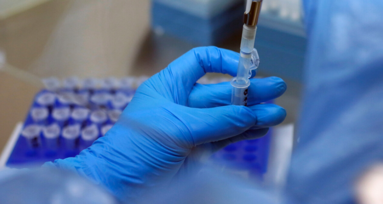 Activan protocolo de vigilancia en La Araucanía ante un posible arribo de casos de viruela del mono