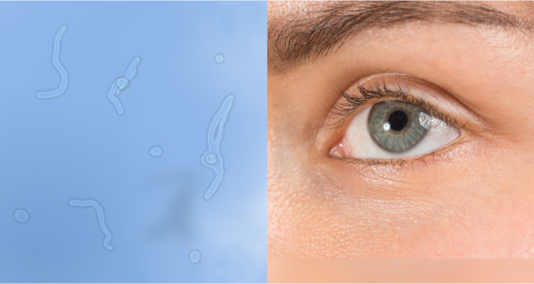 pequeñas pelusas en los ojos