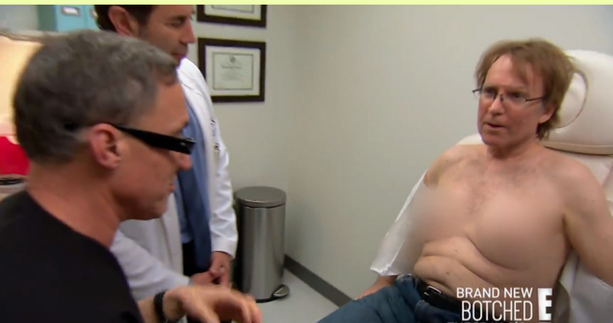 El hombre Copa C: vive hace décadas con implantes mamarios tras apuesta.