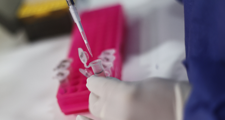 Minsal confirma segundo caso de Viruela del Mono en Chile: persona vive en Angol