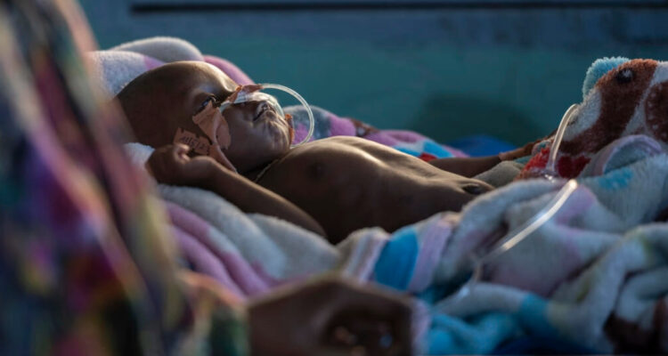 Advierten que crisis alimentaria global provocará “millones de muertos” por enfermedades infecciosas