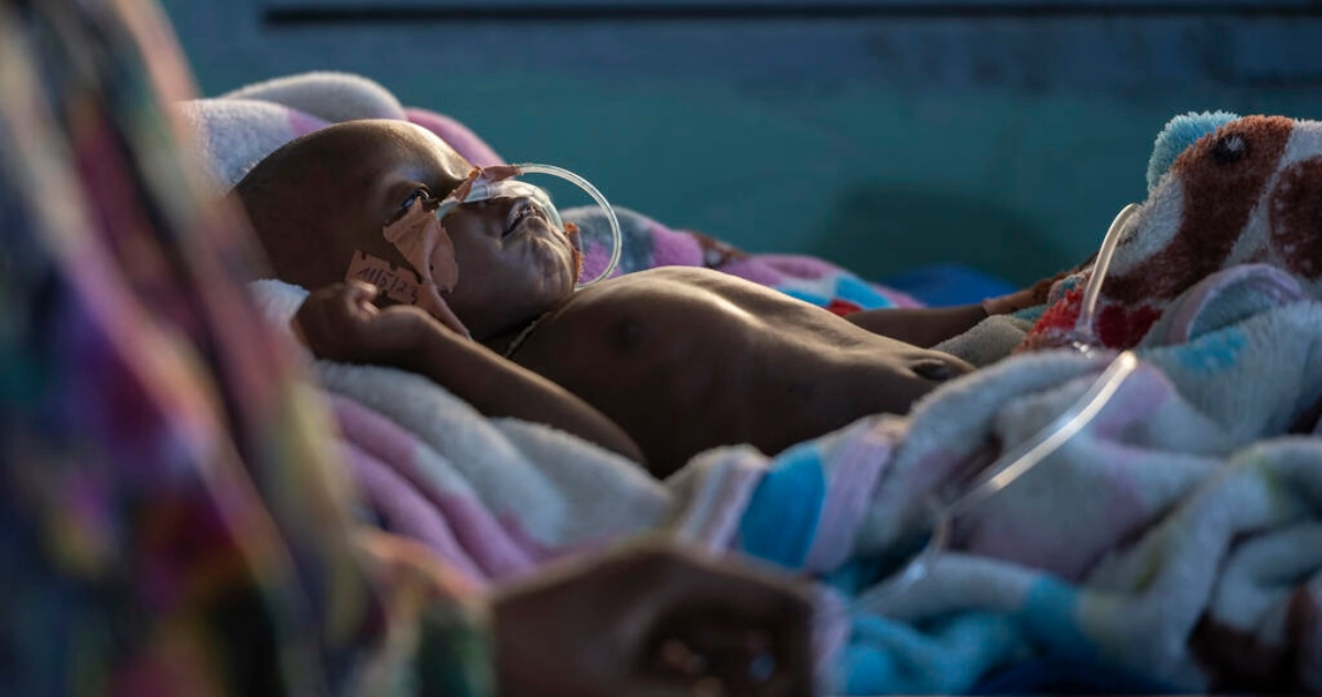 Advierten que crisis alimentaria global provocará “millones de muertos” por enfermedades infecciosas