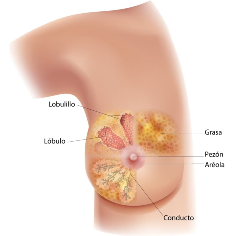 diagrama-del-cancer-de-mama-cdc