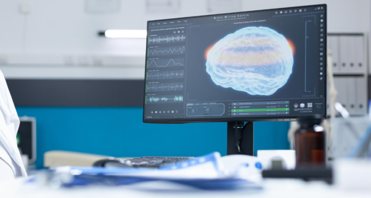 examen-cerebral-ela-escleroris-lateral-amiotrofica