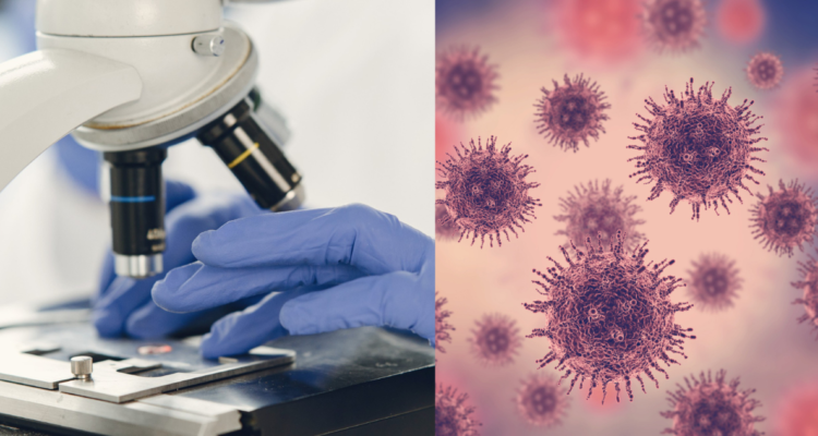 laboratorio-biopsia-celulas-de-cancer