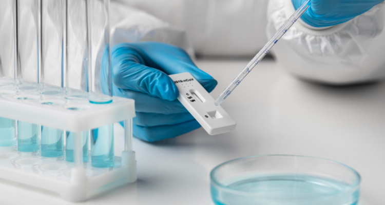 examen-pcr-viruela-del-mono-en-chile