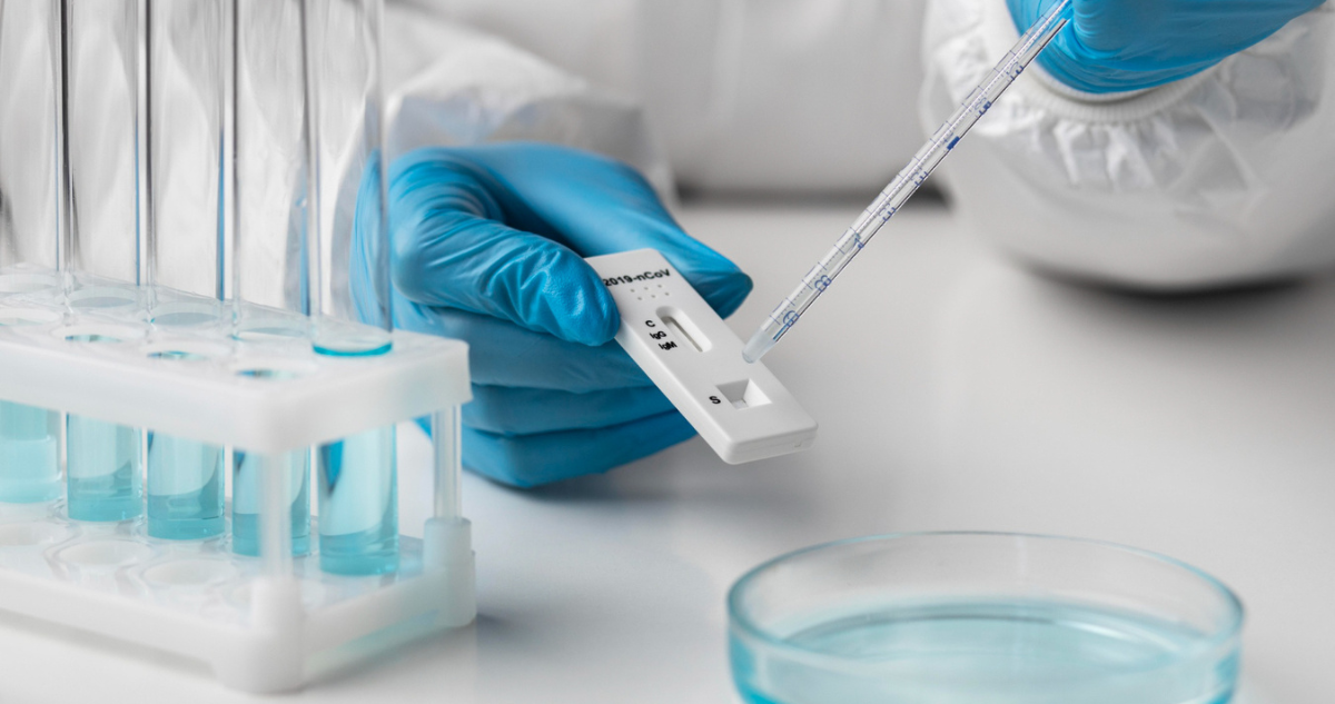 examen-pcr-viruela-del-mono-en-chile