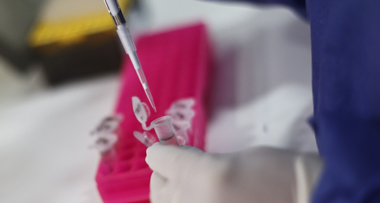 toma-muestra-pcr-viruela-del-mono