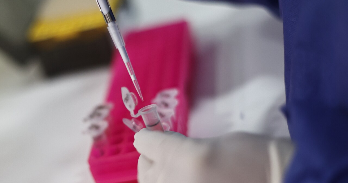 toma-muestra-pcr-viruela-del-mono