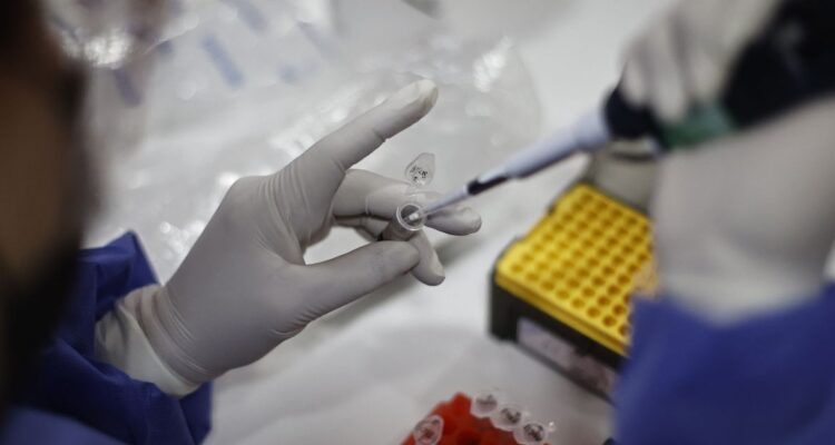 Viruela del mono Chile