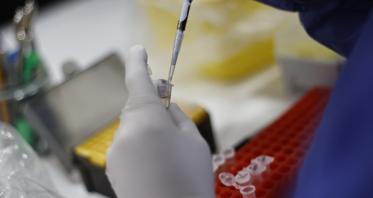 viruela del mono en Chile