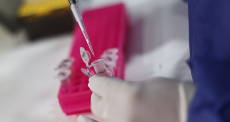 viruela del mono en Chile