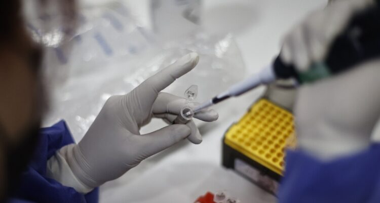 Viruela del mono en Chile