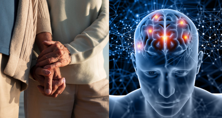 alzheimer-imagenes-manipuladas