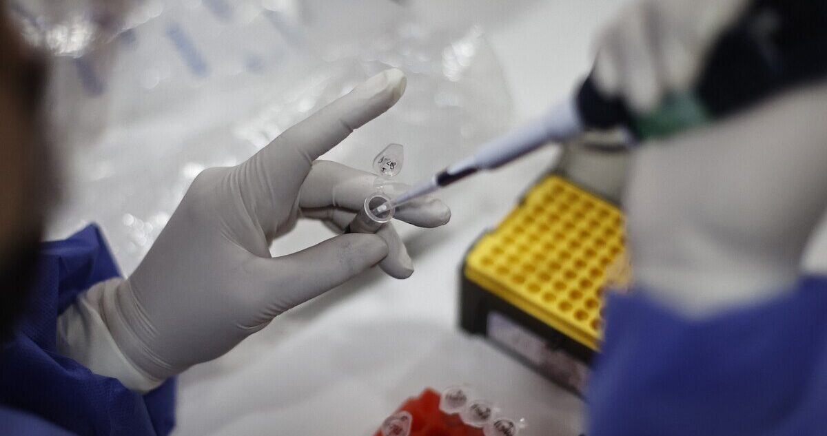 Pruebas de laboratorio por viruela del mono
