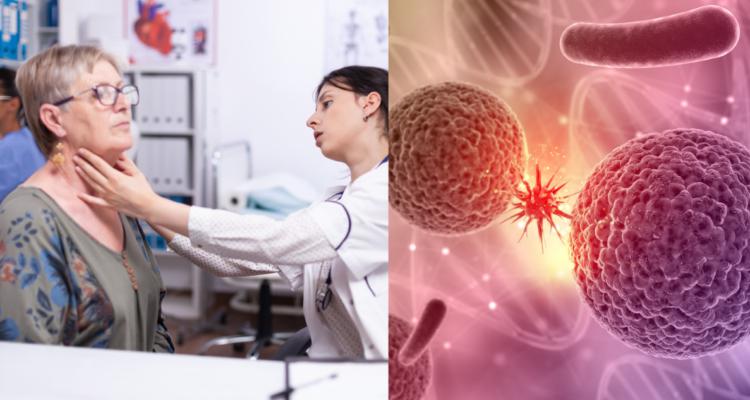 dia-del-cancer-de-cuello-y-cabeza-virus-del-papiloma