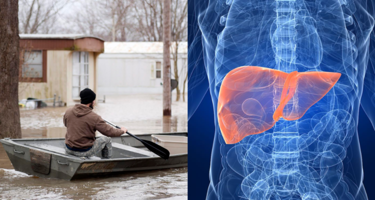 inundaciones-hepatitis-cambio-climatico