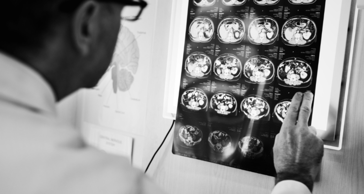 nuevos-sintomas-viruela-del-mono