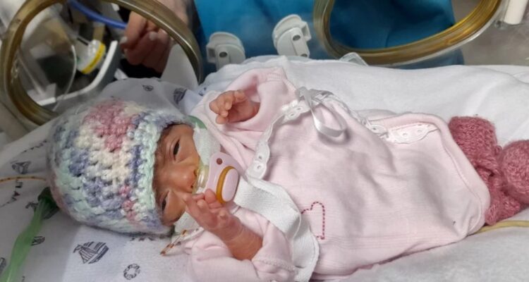 Olivia, la bebé uruguaya que nació con 330 gramos y marcó un hito en Sudamérica