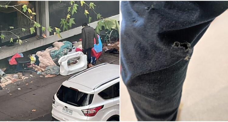 perro de personas en situación de calle muerde a vecino en COncepción