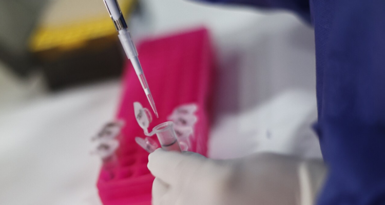 Minsal confirma ocho casos de viruela del mono.