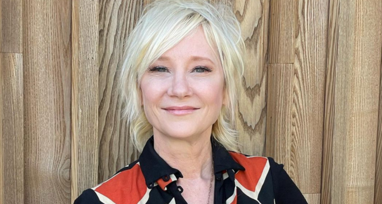 Anne Heche con muerte cerebral