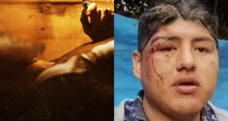 Hombre enterrado vivo en ataúd