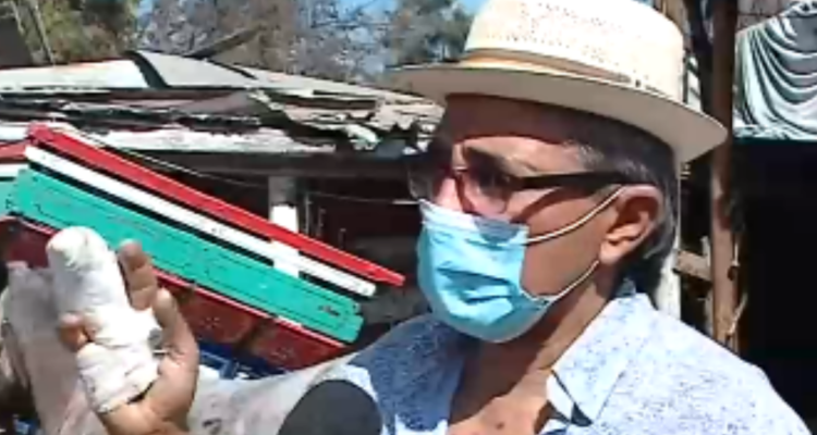 Carretonero acusado de atropellar a ciclistas explica cómo se franturó: “Tiraban piedras para allá y para acá”