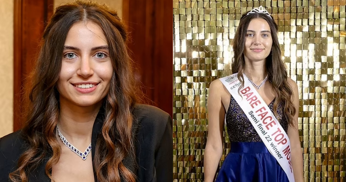 de Miss Inglaterra compite sin usar nada de maquillaje: busca estándares de belleza | Sociedad | BioBioChile