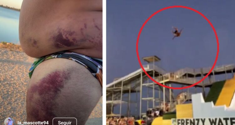 Heridas por salto desde tobogán de piscina en Francia