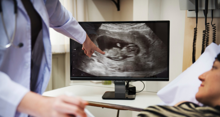 mapeo-desarrollo-embrionario