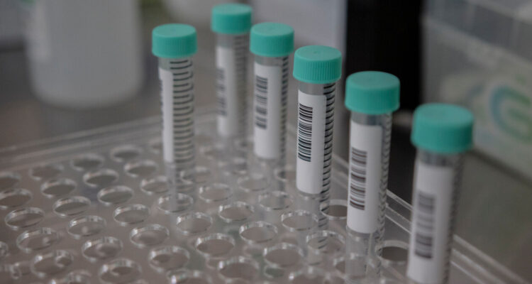 Contagios por viruela del mono aumentan un 25% y casos llegan a 189 a nivel nacional