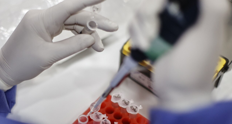 ISP confirma el primer caso de viruela del mono en la región del Bío Bío.