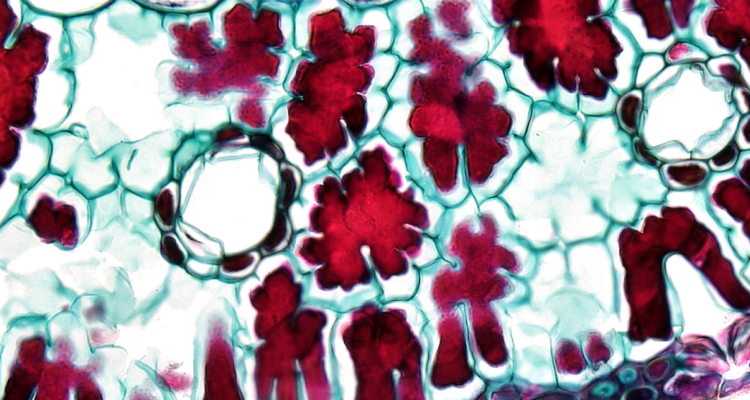 Imagen de una célula. Científicos habrían capturado por primera vez como el virus del Covid infecta una célula