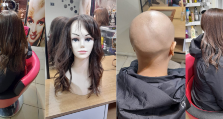 Hospital regional de Temuco invita a realizar donaciones de cabello para pacientes oncológicas