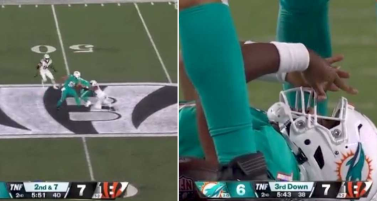 Impactante lesión en la NFL.