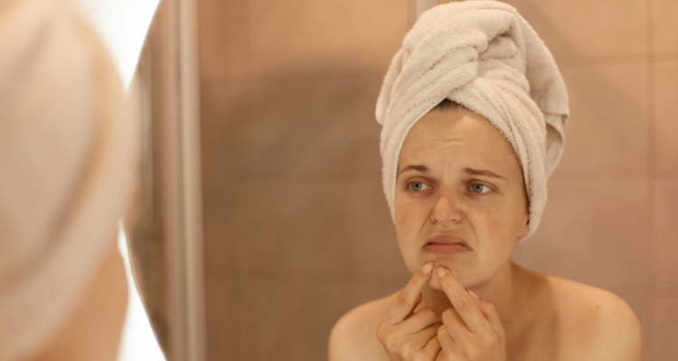 Mujer revisando una erupción de acné en su reflejo en el espejo