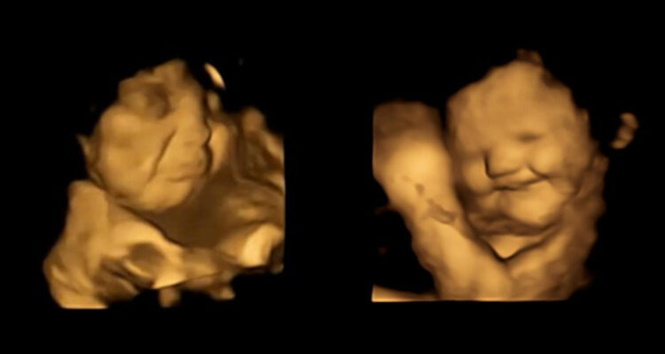 Primera evidencia directa de que los bebés reaccionan al gusto y olfato desde el útero