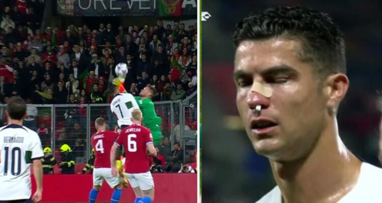 Cristiano Ronaldo termina ensangrentado tras fuerte choque