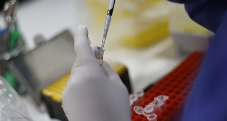 Viruela del Mono Arica