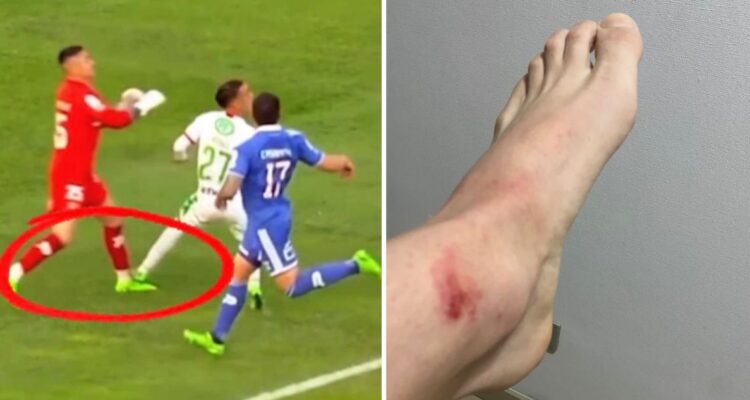 Cristóbal Campos se lanza contra el VAR tras derrota de la U ante Audax