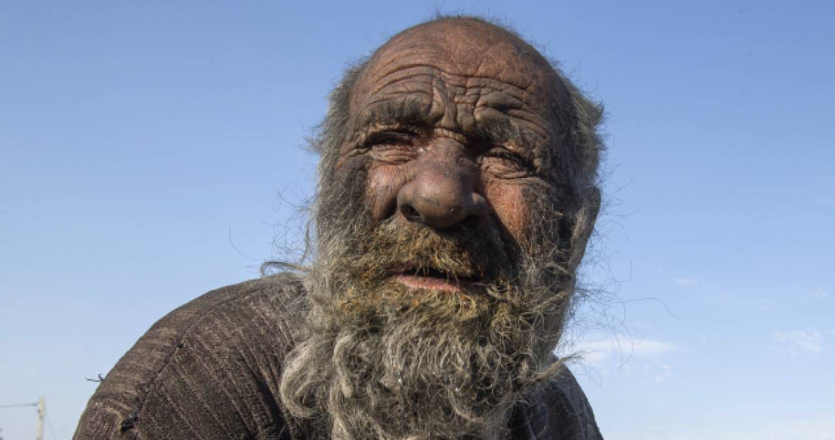 Murió el Hombre más sucio del mundo