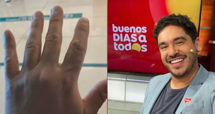 Gino Costa se ausenta de matinal de TVN por extraña lesión